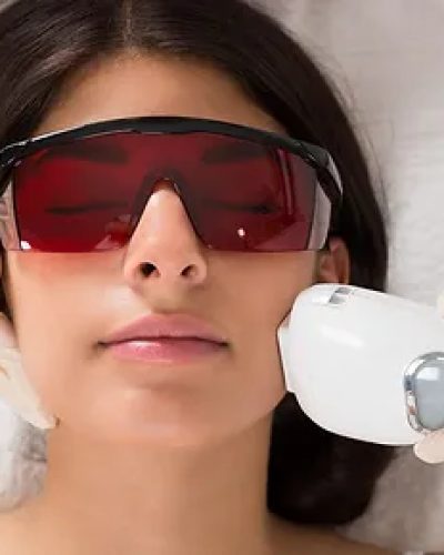 Laser Skin Treatment