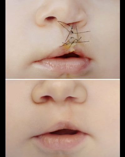 Reconstructive Plastic Surgery