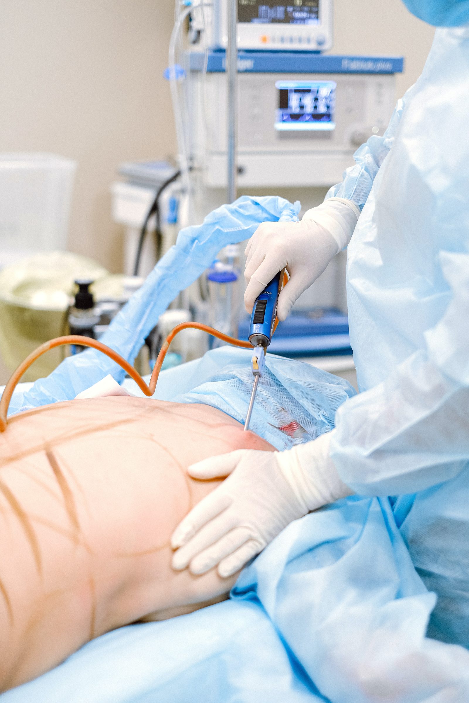 Gynecomastia and Liposuction - Dr. Vivek Gupta's Clinic, Lucknow